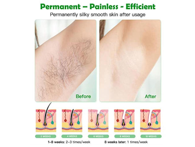 At-Home IPL Hair Removal for Women & Men