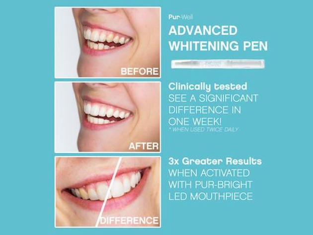 Pur-White Smart Teeth Whitening System