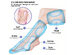 xPulse Leg Recovery System