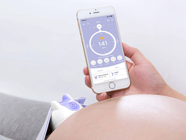 Roo Prenatal Heartbeat Monitor (Lavender)