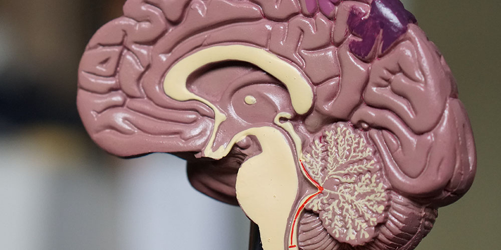 Neuroplasticity: How to Rewire Your Brain