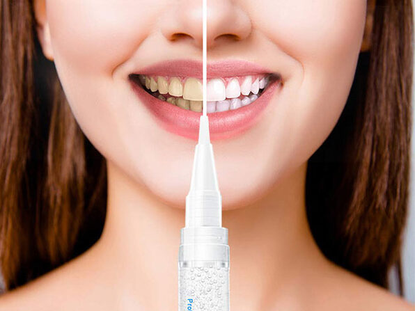 SweetWhite Professional Teeth Whitening Pen: 2-Pack ...